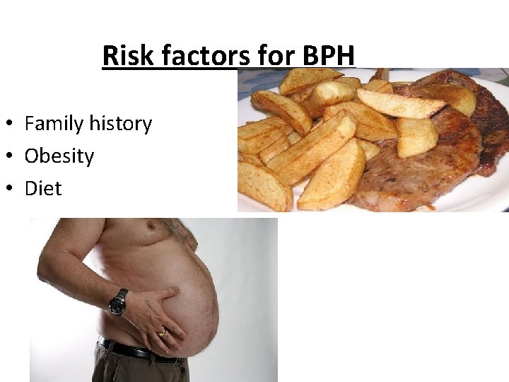 Risk factors for BPH • Family history • Obesity • Diet 