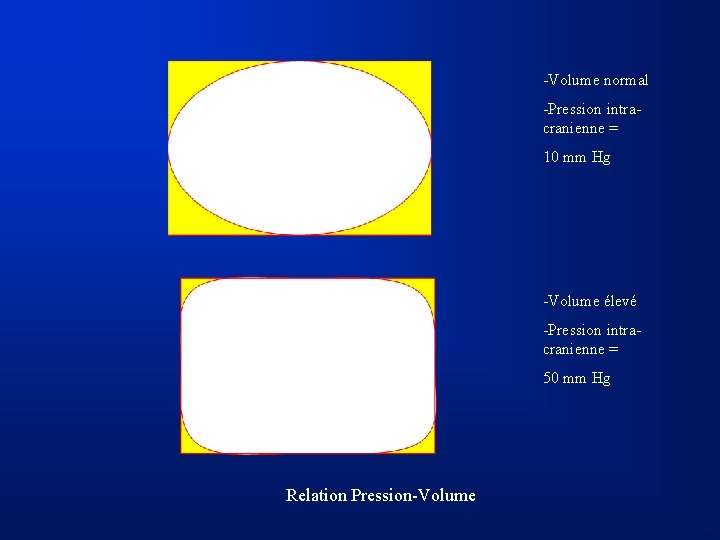 -Volume normal -Pression intracranienne = 10 mm Hg -Volume élevé -Pression intracranienne = 50