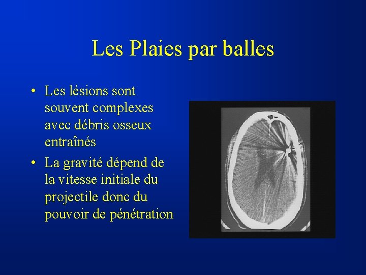 Les Plaies par balles • Les lésions sont souvent complexes avec débris osseux entraînés