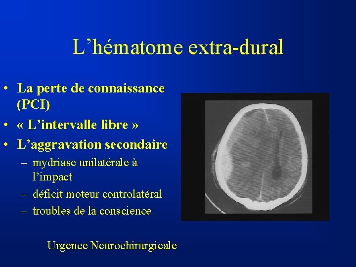 L’hématome extra-dural • La perte de connaissance (PCI) • « L’intervalle libre » •