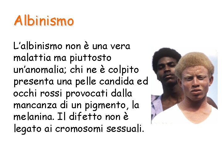 Albinismo L’albinismo non è una vera malattia ma piuttosto un’anomalia; chi ne è colpito