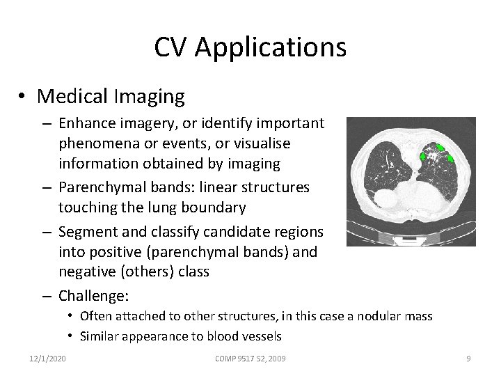 CV Applications • Medical Imaging – Enhance imagery, or identify important phenomena or events,