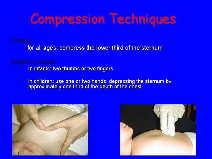 Compression Techniques Position: for all ages: compress the lower third of the sternum number