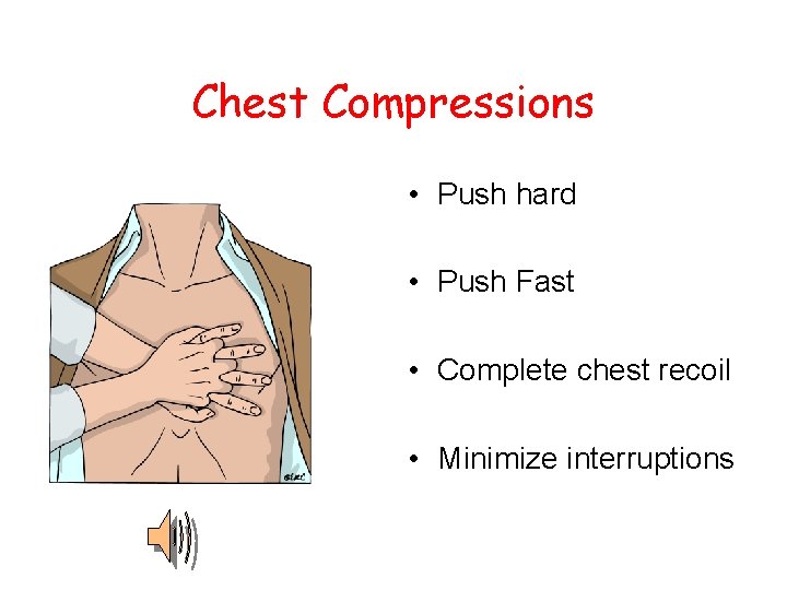 Chest Compressions • Push hard • Push Fast • Complete chest recoil • Minimize