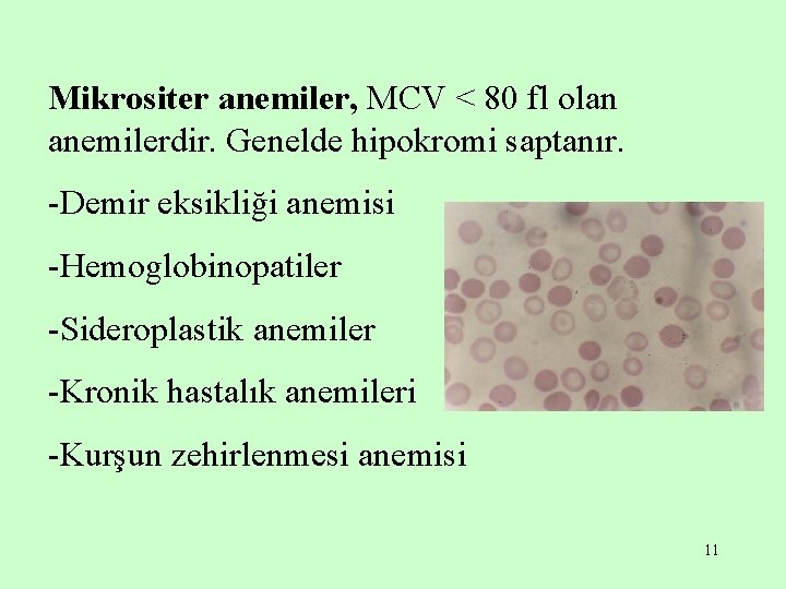 Mikrositer anemiler, MCV < 80 fl olan anemilerdir. Genelde hipokromi saptanır. -Demir eksikliği anemisi