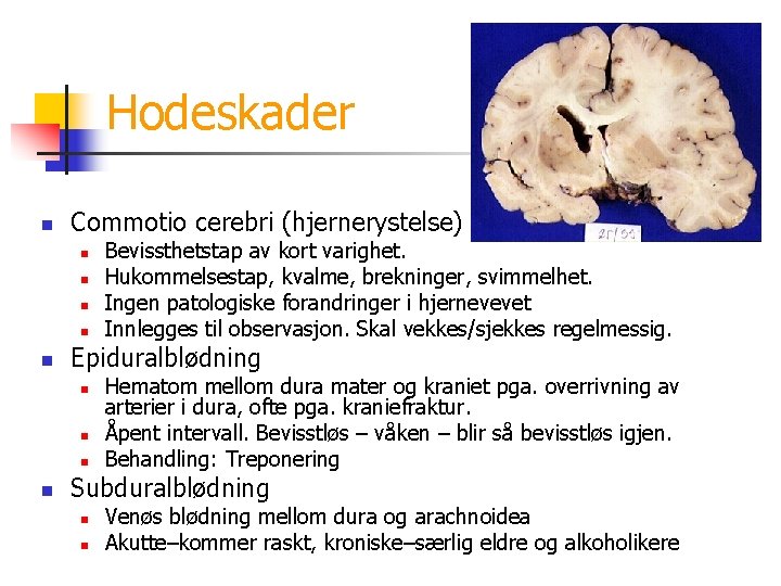 Hodeskader n Commotio cerebri (hjernerystelse) n n n Epiduralblødning n n Bevissthetstap av kort