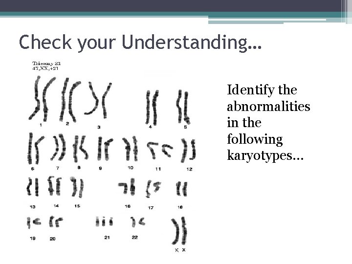 Check your Understanding… Identify the abnormalities in the following karyotypes… 
