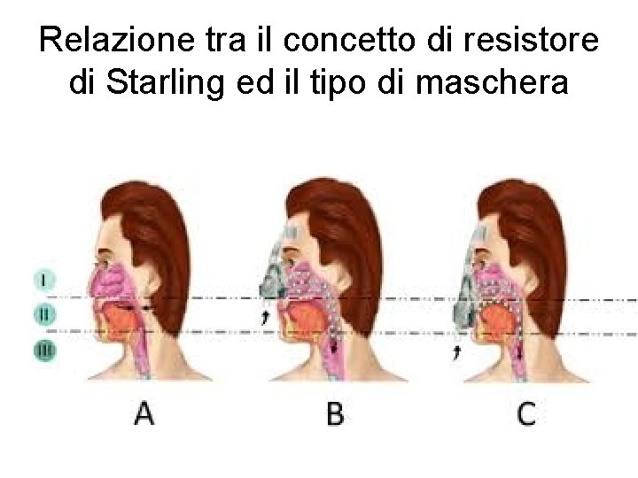 Relazione tra il concetto di resistore di Starling ed il tipo di maschera 