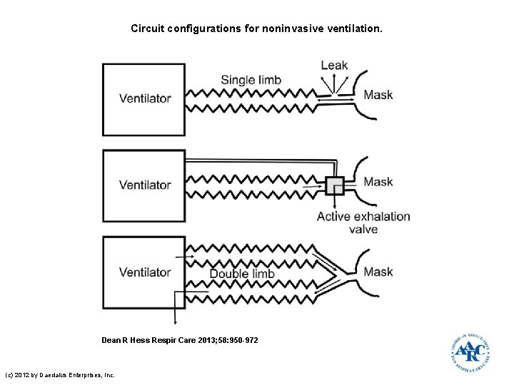 Circuit configurations for noninvasive ventilation. Dean R Hess Respir Care 2013; 58: 950 -972