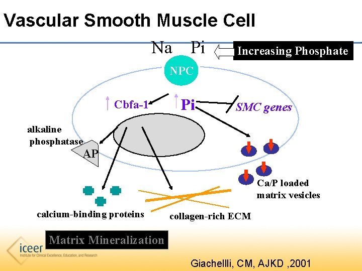 Vascular Smooth Muscle Cell Na Pi Increasing Phosphate NPC Cbfa-1 Pi SMC genes alkaline