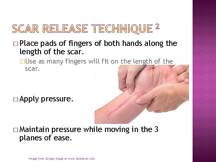 � Place pads of fingers of both hands along the length of the scar.