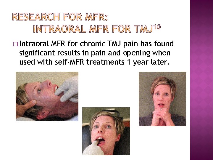 � Intraoral MFR for chronic TMJ pain has found significant results in pain and