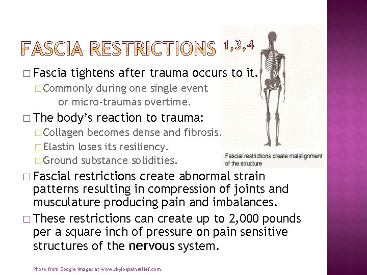 � Fascia tightens after trauma occurs to it. � Commonly during one single event