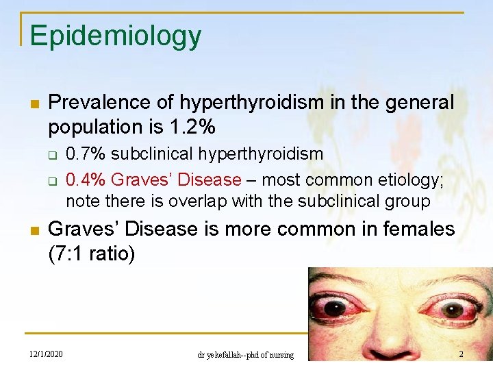 Epidemiology n Prevalence of hyperthyroidism in the general population is 1. 2% q q