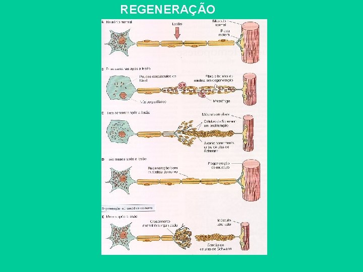 REGENERAÇÃO 