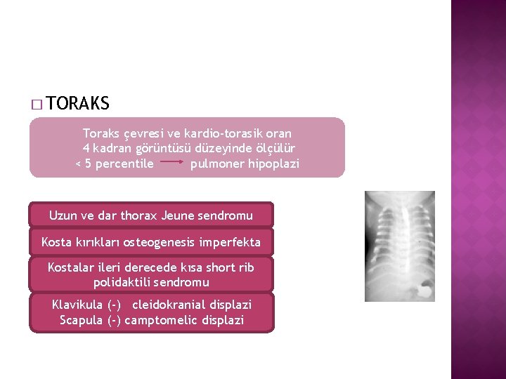 � TORAKS Toraks çevresi ve kardio-torasik oran 4 kadran görüntüsü düzeyinde ölçülür < 5