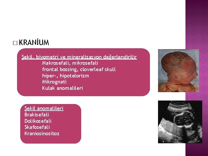 � KRANİUM Şekil, biyometri ve mineralizasyon değerlendirilir Makrosefali, mikrosefali frontal bossing, cloverleaf skull hiper-,