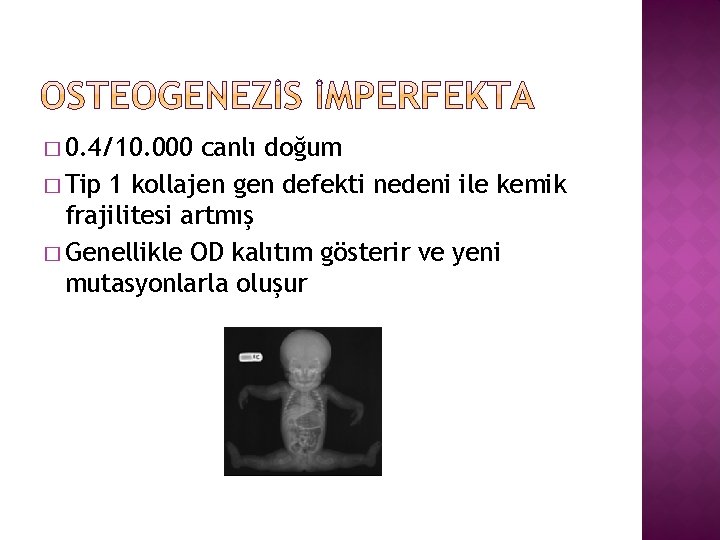 � 0. 4/10. 000 canlı doğum � Tip 1 kollajen gen defekti nedeni ile