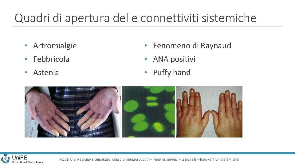 Quadri di apertura delle connettiviti sistemiche • Artromialgie • Fenomeno di Raynaud • Febbricola
