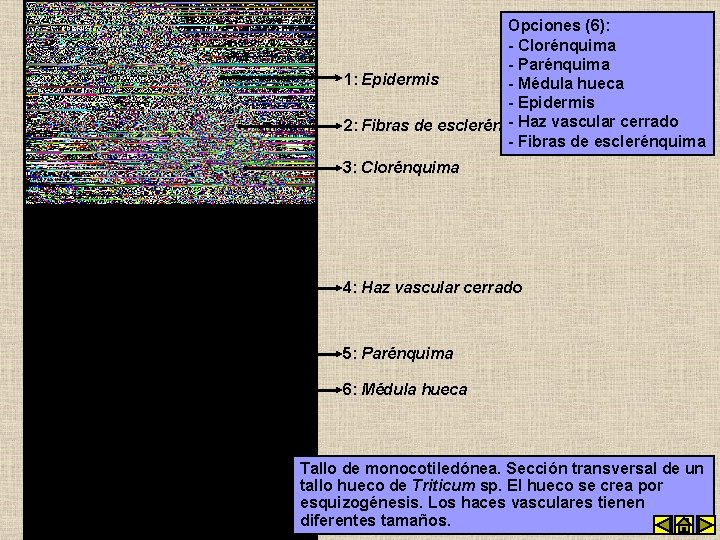 Opciones (6): - Clorénquima - Parénquima 1: Epidermis - Médula hueca - Epidermis -