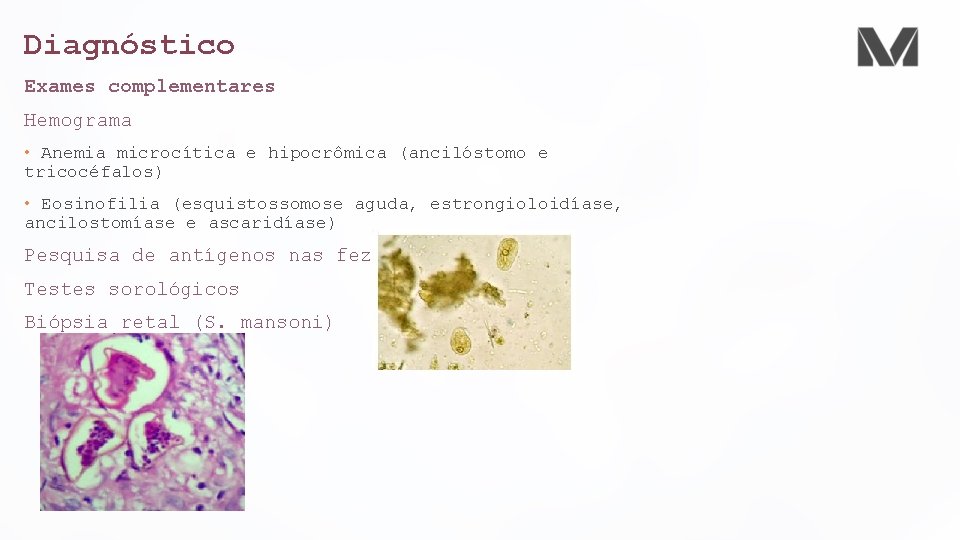 Diagnóstico Exames complementares Hemograma • Anemia microcítica e hipocrômica (ancilóstomo e tricocéfalos) • Eosinofilia Diagnóstico Exames complementares Hemograma • Anemia microcítica e hipocrômica (ancilóstomo e tricocéfalos) • Eosinofilia