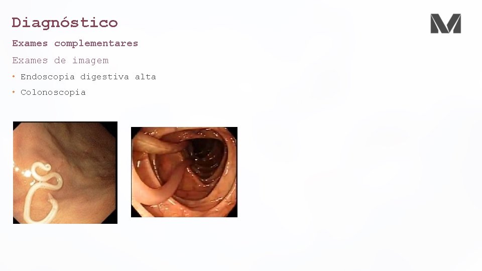 Diagnóstico Exames complementares Exames de imagem • Endoscopia digestiva alta • Colonoscopia Diagnóstico Exames complementares Exames de imagem • Endoscopia digestiva alta • Colonoscopia