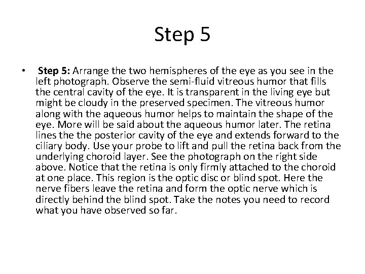 Step 5 • Step 5: Arrange the two hemispheres of the eye as you