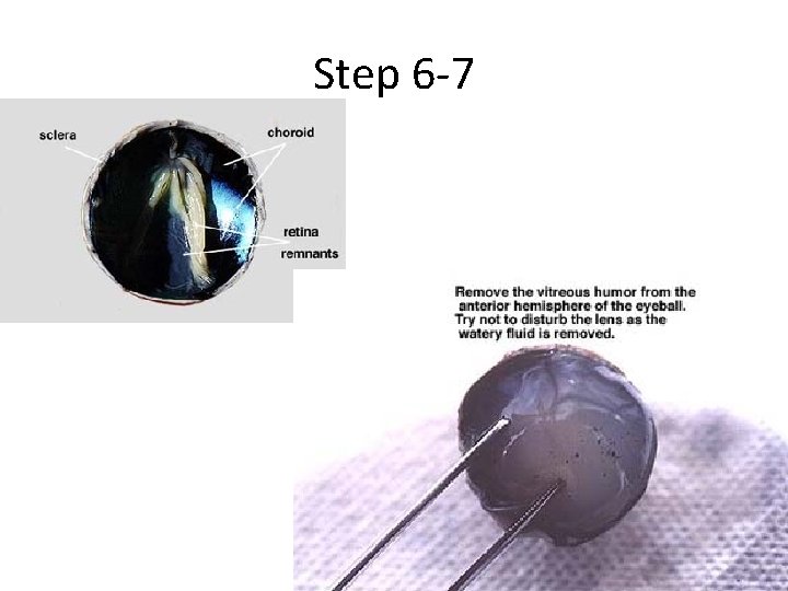 Step 6 -7 