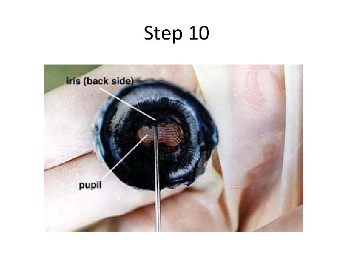 Step 10 