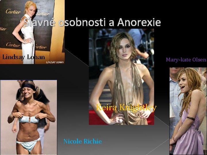 Slavné osobnosti a Anorexie Lindsay Lohan Mary-kate Olsen Keira Knightley Nicole Richie 