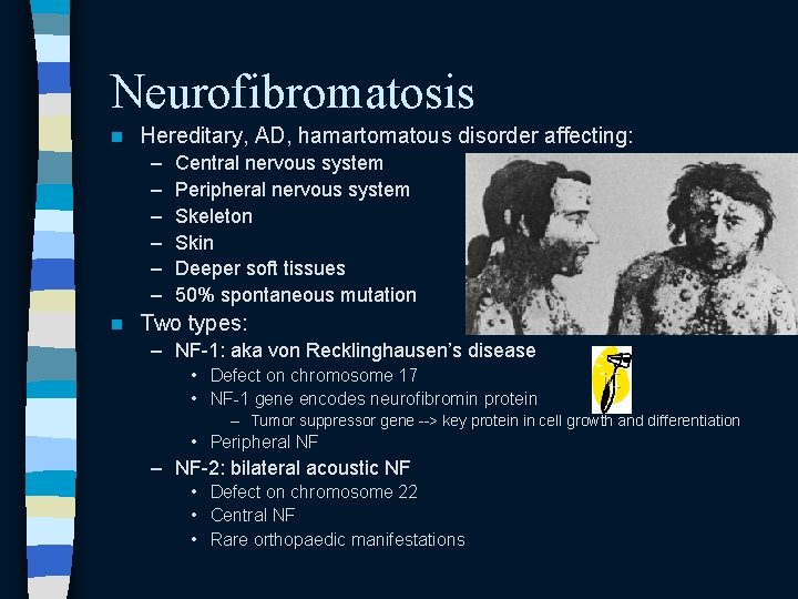Neurofibromatosis n Hereditary, AD, hamartomatous disorder affecting: – – – n Central nervous system Neurofibromatosis n Hereditary, AD, hamartomatous disorder affecting: – – – n Central nervous system
