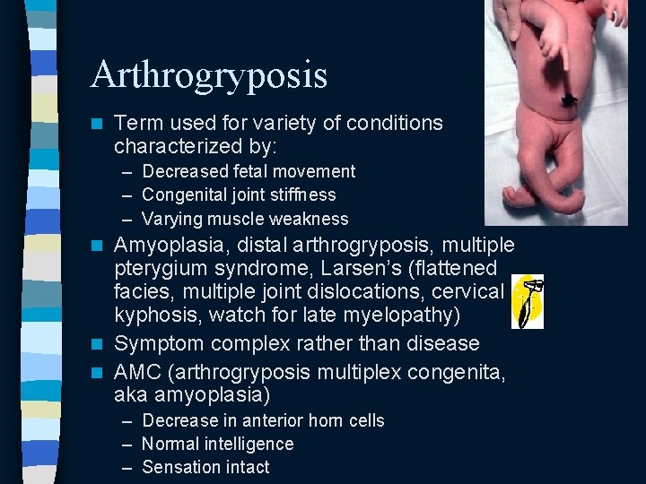 Arthrogryposis n Term used for variety of conditions characterized by: – Decreased fetal movement Arthrogryposis n Term used for variety of conditions characterized by: – Decreased fetal movement