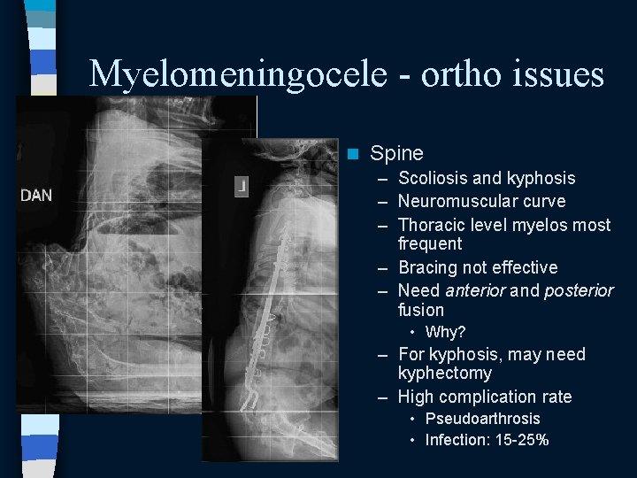 Myelomeningocele - ortho issues n Spine – Scoliosis and kyphosis – Neuromuscular curve – Myelomeningocele - ortho issues n Spine – Scoliosis and kyphosis – Neuromuscular curve –