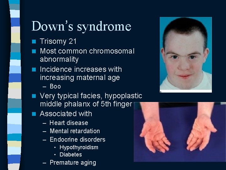 Down’s syndrome Trisomy 21 n Most common chromosomal abnormality n Incidence increases with increasing Down’s syndrome Trisomy 21 n Most common chromosomal abnormality n Incidence increases with increasing