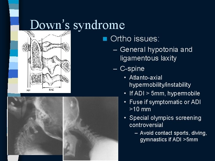 Down’s syndrome n Ortho issues: – General hypotonia and ligamentous laxity – C-spine • Down’s syndrome n Ortho issues: – General hypotonia and ligamentous laxity – C-spine •