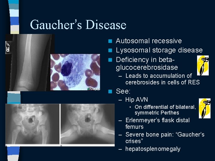 Gaucher’s Disease Autosomal recessive n Lysosomal storage disease n Deficiency in betaglucocerebrosidase n – Gaucher’s Disease Autosomal recessive n Lysosomal storage disease n Deficiency in betaglucocerebrosidase n –