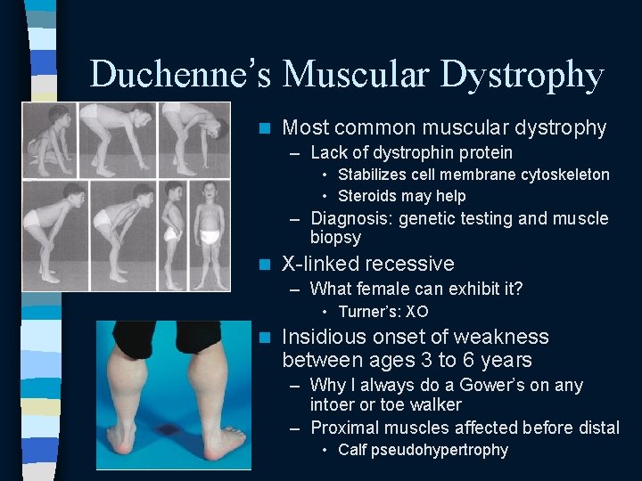 Duchenne’s Muscular Dystrophy n Most common muscular dystrophy – Lack of dystrophin protein • Duchenne’s Muscular Dystrophy n Most common muscular dystrophy – Lack of dystrophin protein •