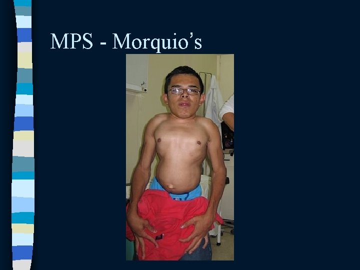 MPS - Morquio’s MPS - Morquio’s