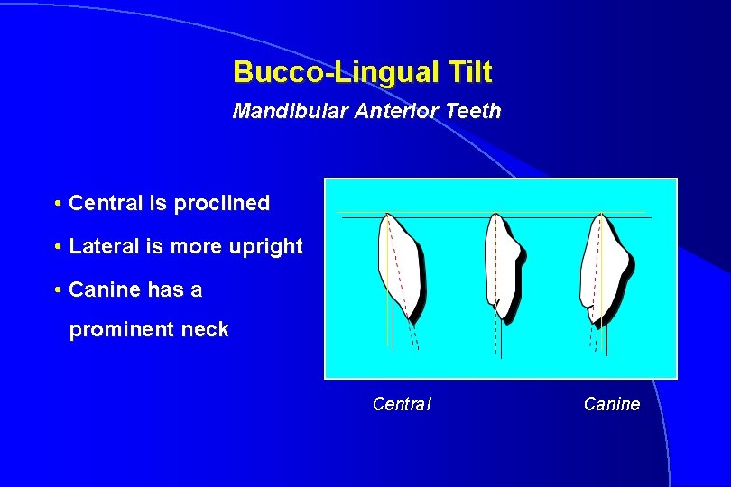 Bucco-Lingual Tilt Mandibular Anterior Teeth • Central is proclined • Lateral is more upright