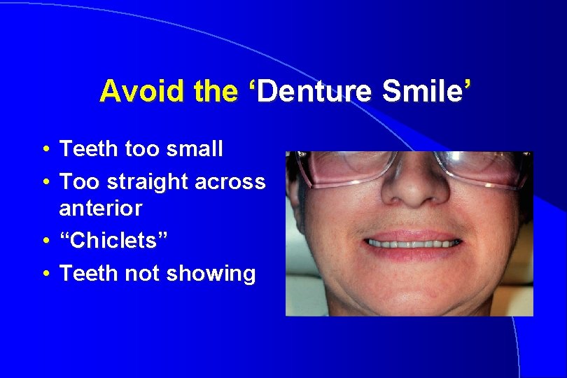 Avoid the ‘Denture Smile’ • Teeth too small • Too straight across anterior •