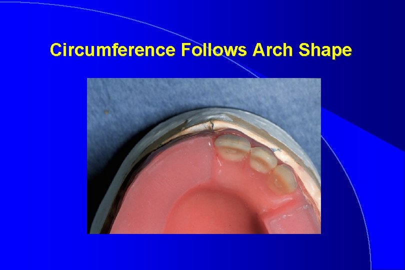 Circumference Follows Arch Shape 