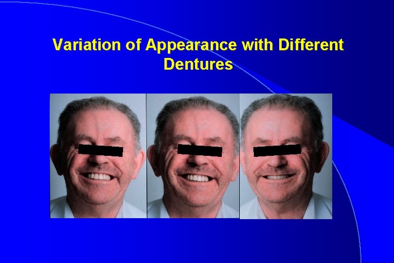 Variation of Appearance with Different Dentures 