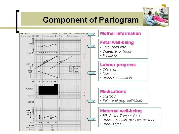 Component of Partogram Mother information Fetal well-being • Fetal heart rate • Character of