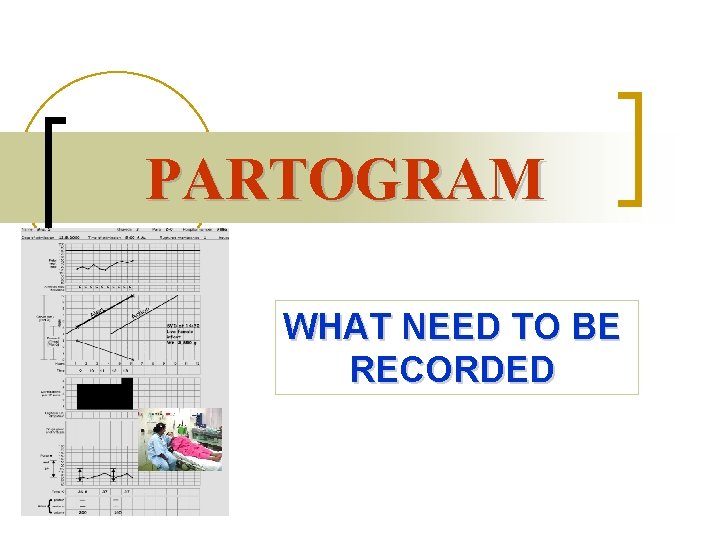 PARTOGRAM WHAT NEED TO BE RECORDED 