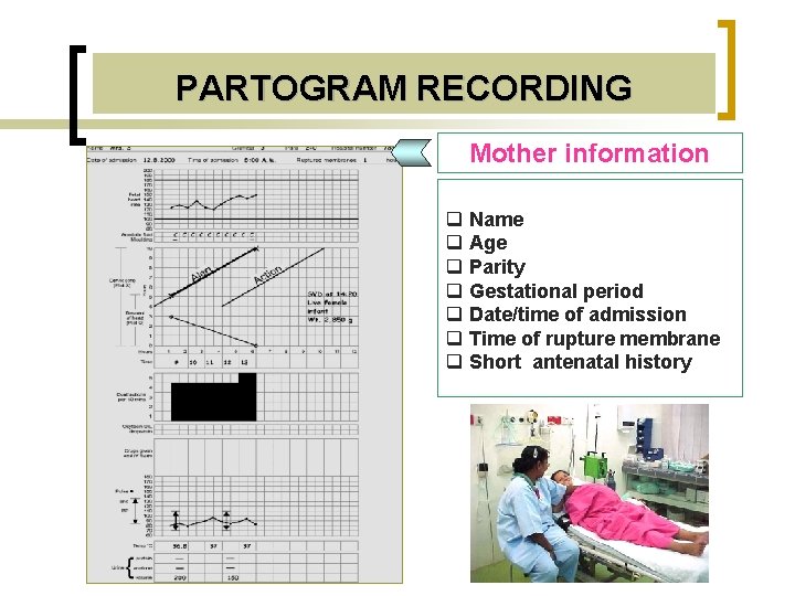 PARTOGRAM RECORDING Mother information q Name q Age q Parity q Gestational period q