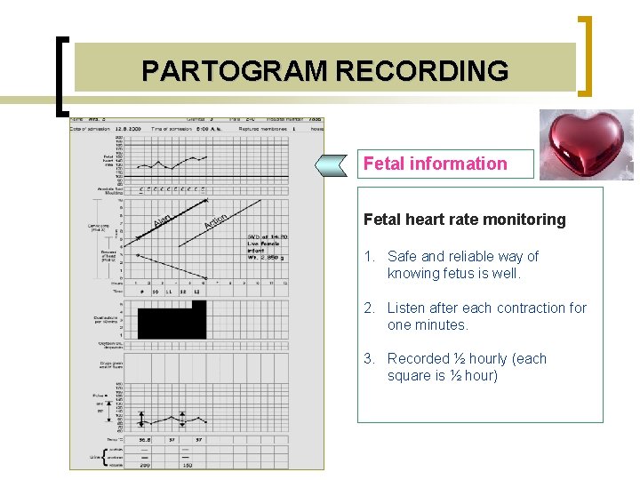 PARTOGRAM RECORDING Fetal information Fetal heart rate monitoring 1. Safe and reliable way of