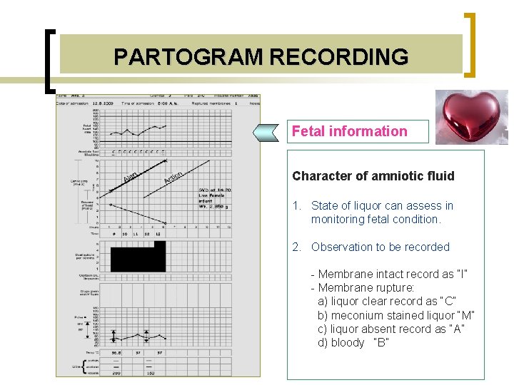 PARTOGRAM RECORDING Fetal information Character of amniotic fluid 1. State of liquor can assess