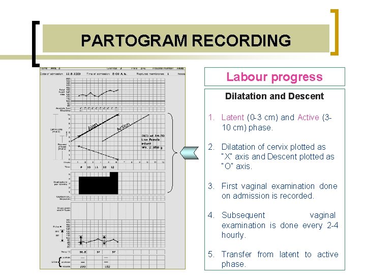 PARTOGRAM RECORDING Labour progress Dilatation and Descent 1. Latent (0 -3 cm) and Active