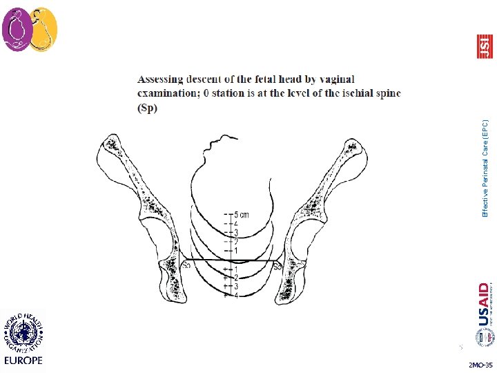 35 2 MO-35 Effective Perinatal Care (EPC) 