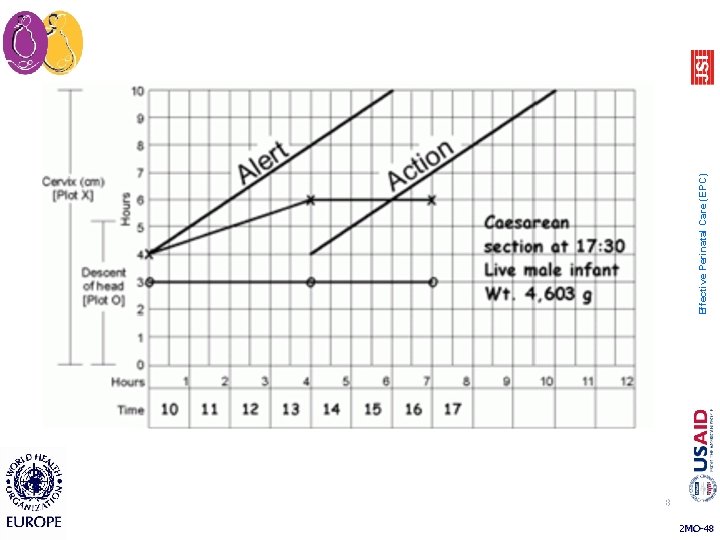 48 2 MO-48 Effective Perinatal Care (EPC) 